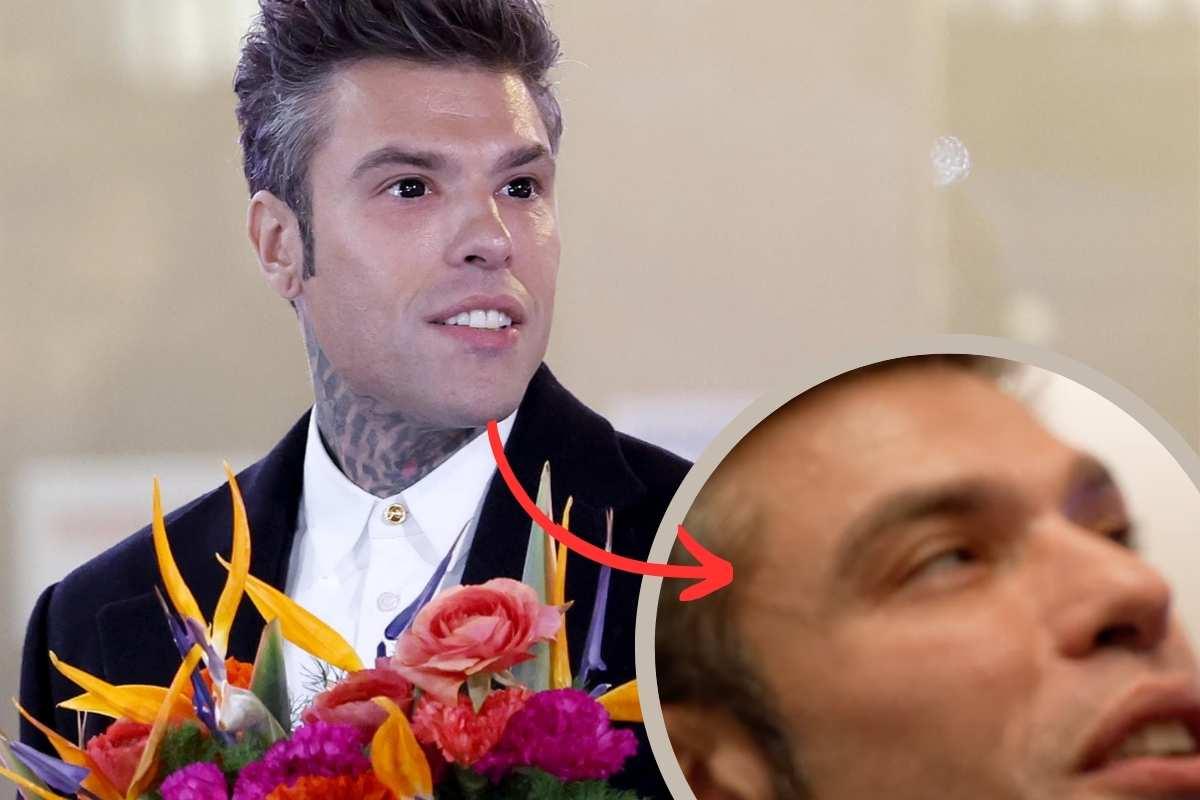 Fedez lenti